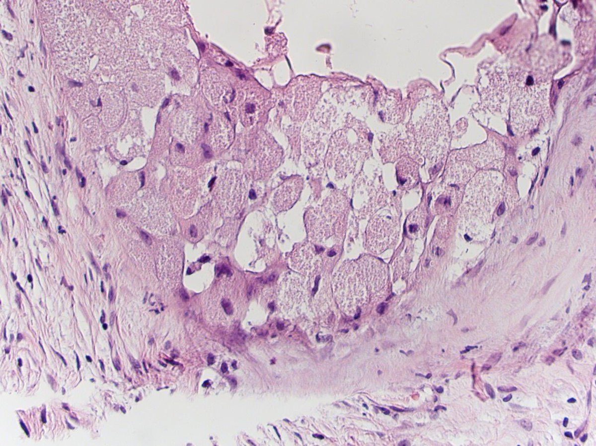 Tim Bracey tweet media