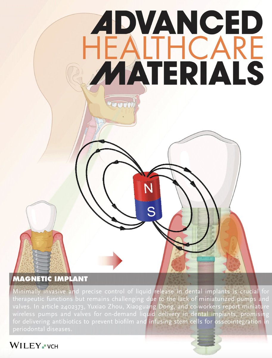 And now for something a little different: Dong Lab has designed miniature wireless pumps and valves for on-demand liquid delivery in dental implants. Check it out in Advanced Healthcare Materials: onlinelibrary.wiley.com/doi/abs/10.100…