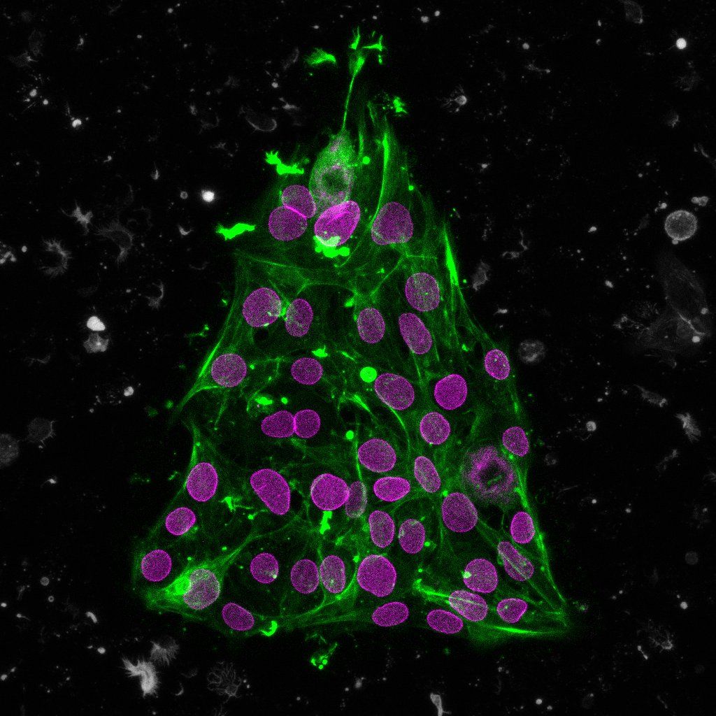Allen Institute (@alleninstitute) on Twitter photo How convenient - this tree already comes with ornaments!
Get into the holiday spirit with this beautiful cell tree by <a href="/oozguc/">Özge Özgüç</a> from @ibecbarcelona. This beautiful fusion of science and art was made using our Lamin B1 stem cell line - complete with pink nuclei ornaments! How convenient - this tree already comes with ornaments!
Get into the holiday spirit with this beautiful cell tree by <a href="/oozguc/">Özge Özgüç</a> from @ibecbarcelona. This beautiful fusion of science and art was made using our Lamin B1 stem cell line - complete with pink nuclei ornaments!