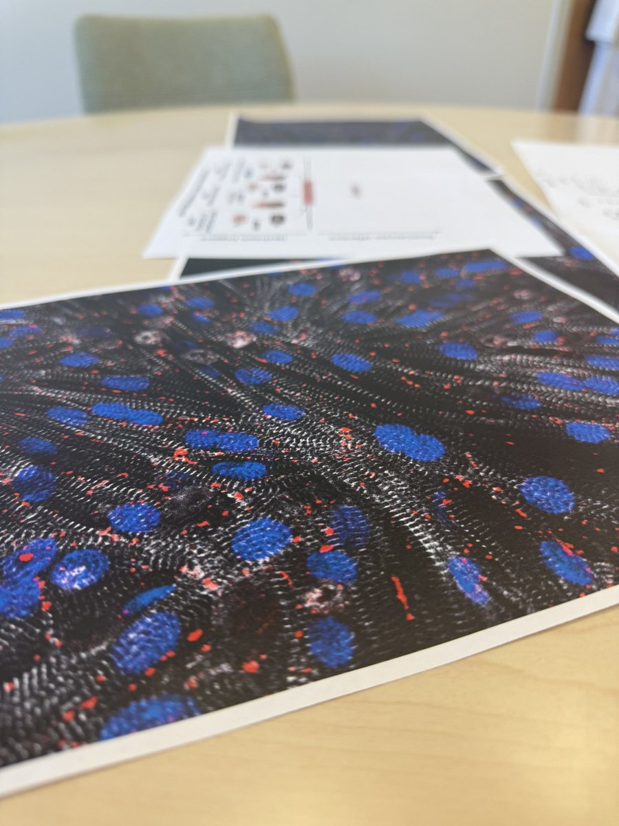 EugenioCingolan's tweet photo. Always refreshing to go over #NiceLooking #Data together with @ThassioMesquita and @MarbanLab #Tuesdays ➡️ @SmidtHeart @CedarsSinaiMed @CedarsSinai #Arryhmias #Mechanisms #NewTherapeutics #Science https://t.co/joYWwsgeAP