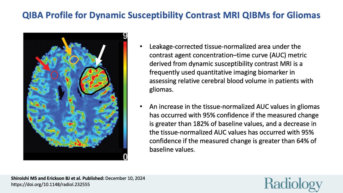 NimaAmeliMed's tweet image. Excited to share our work published in the Radiology Journal!
Grateful to my mentor, Dr. Shiroishi, for his invaluable guidance and support.
🔗 doi.org/10.1148/radiol…
#Radiology #Glioma #QuantitativeImaging #NeuroOncology #QIBA #USCRadiologyResearch #match2025