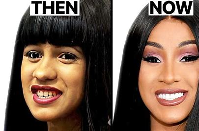 laputana49's tweet photo. @Queenminajkk @iamcardib Been botched🤪 https://t.co/ocEvLpIPFW