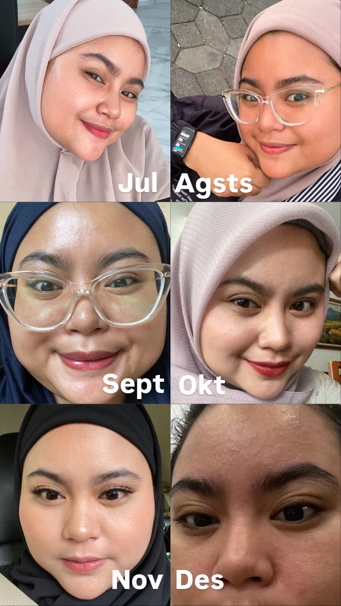 Shelli dalam setahun✨

Hidup kadang kidding, kulit kadang mulus kadang berontak🫵🏻