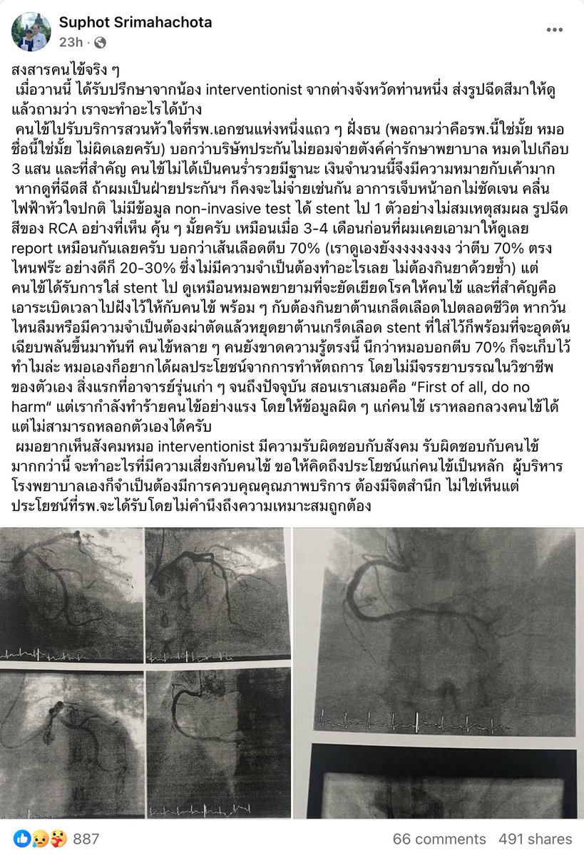 วงการแพทย์มีเรื่องแซ่บ ๆ อีกแล้วววว
อันนี้แบบไม่ไหวจริงงงง 🌚