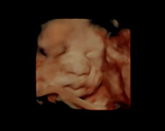 sooitskara's tweet photo. Life update 🤰🏽🥰 https://t.co/OKSPI9puqE