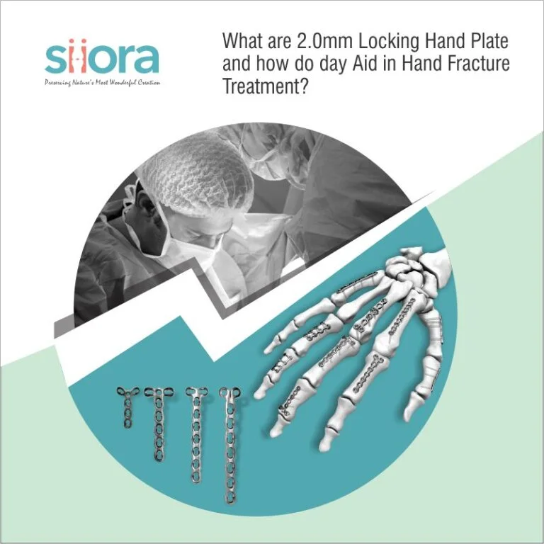 siorasurgicals's tweet image. These plates are specifically designed to address the unique anatomical and functional needs of the hand.
siiora.com/blogs/2mm-lock…
#HandFractures #2mmLockingPlates #LockingPlates #OrthopedicSurgery  #OrthopedicCare #FractureTreatment #HandSurgery #SioraSurgicals