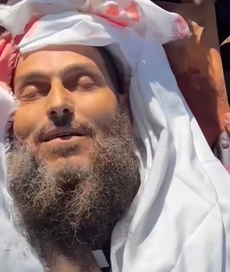 Prophet Muhammad ﷺ said,

"Whoever Loves to meet Allah ﷻ, Allah loves to meet him"