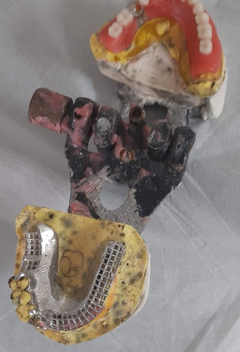 Kamu diş hekimi aşağıdaki resimdeki gibi 'protez!!' ler ile boğuşuyor...
Kirli demek temiz kalır...
Eğitimsiz ve  kalitesiz diş protez laboratuvarları...
Diş hekiminin malzemeden-süreye hiçbir inisiyatifinin olmadığı protez yapım aşamaları ve bu aşamalar için ayrılan bir zaman