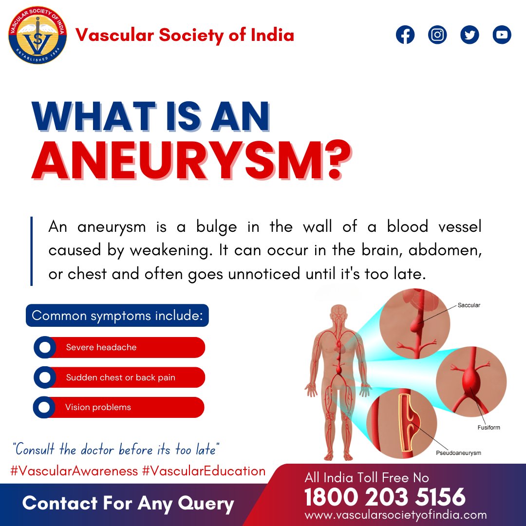 Vascular_India's tweet photo. "What is an aneurysm? It’s more than just a medical term—it could save your life to understand it! 🫀"
.
.
#AneurysmAwareness #HeartHealth #MedicalInsights #HealthEducation #AneurysmPrevention #HealthyLiving #CirculationMatters #CardiacCare #KnowTheSigns #VascularHealth https://t.co/2isnATkM0h