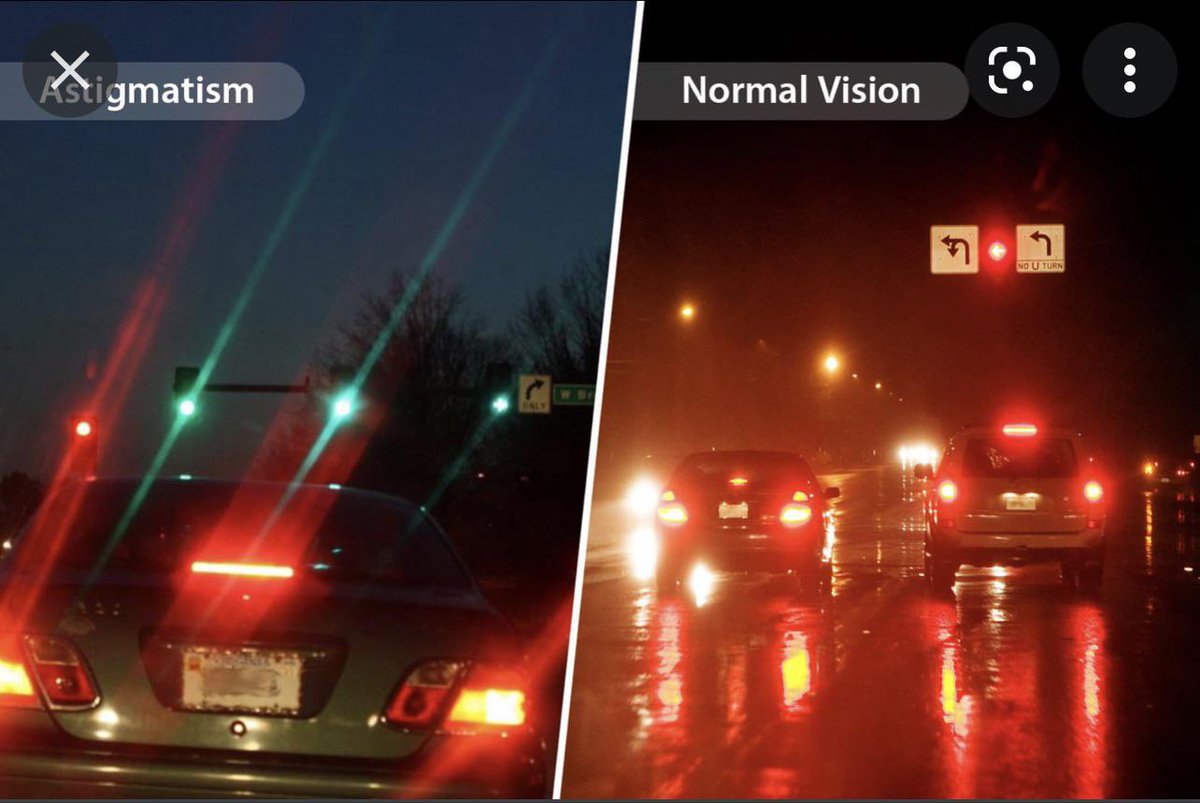 Until recently, i thought everyone saw lights at night like the pic on the left