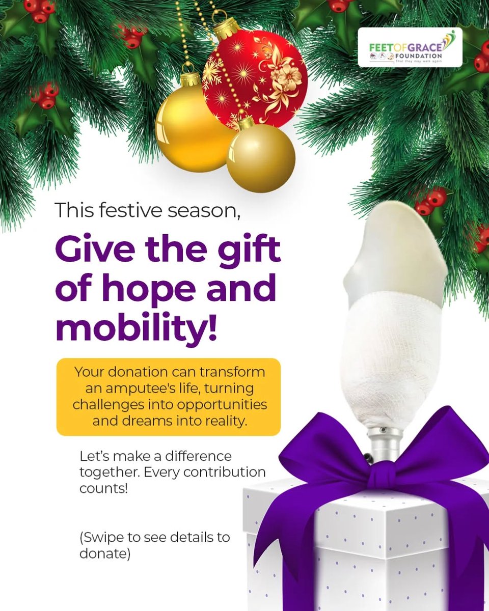 FeetofGrace_F's tweet image. This season, light up lives with hope and mobility!
Swipe to see how you can help transform dreams into reality.
Or use
Nigeria Account: 1019430471
Bank: United Bank of Africa, Nigeria
Or visit our GoFundMe gofund.me/bcde6810
#FeetofGrace #GiftOfMobility  #SpreadTheJoy