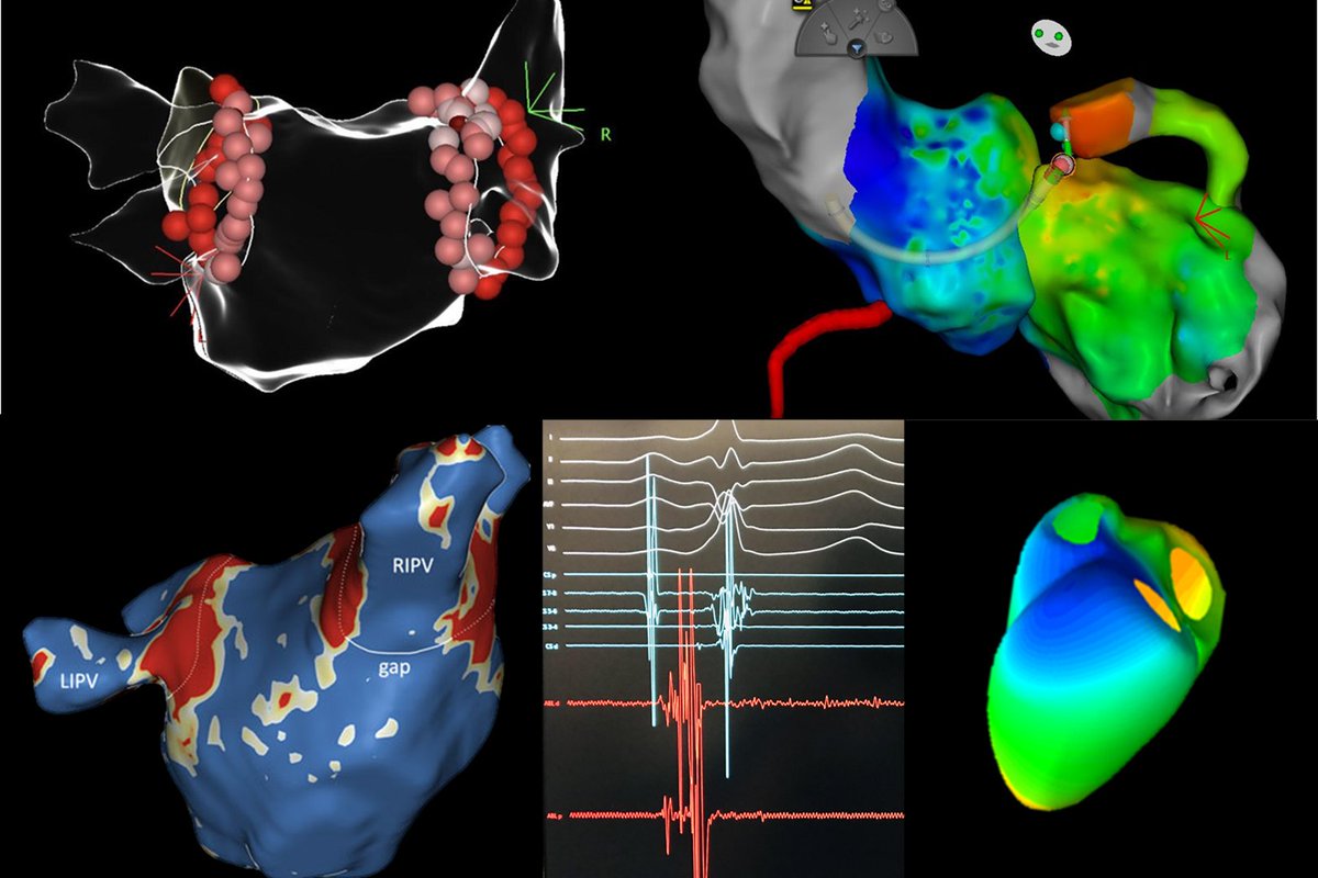 Margarida Pujol Lopez (@margaridapujol) on Twitter photo Nova edició Curs d'Electrofisiologia 🔌💗x Residents
* 10-11 abril 25 * R4-R5.
Contacta amb tutor o Team Arritmies o DM si ets del Clinic.
<a href="/hgermanstrias/">Hosp. Germans Trias</a> <a href="/hospitaldelmar/">Hospital del Mar</a> <a href="/vallhebron/">Vall d'Hebron</a> <a href="/HospitalSantPau/">Sant Pau - Campus Salut Barcelona</a> <a href="/hospitalclinic/">Hospital Clínic</a> <a href="/hbellvitge/">Hospital Universitari Bellvitge | HUB</a> <a href="/SJDbarcelona_es/">Hospital Sant Joan de Déu Barcelona ES</a>
J. Cantalapiedra <a href="/VictorBazanG/">Victor Bazan</a> Nova edició Curs d'Electrofisiologia 🔌💗x Residents
* 10-11 abril 25 * R4-R5.
Contacta amb tutor o Team Arritmies o DM si ets del Clinic.
<a href="/hgermanstrias/">Hosp. Germans Trias</a> <a href="/hospitaldelmar/">Hospital del Mar</a> <a href="/vallhebron/">Vall d'Hebron</a> <a href="/HospitalSantPau/">Sant Pau - Campus Salut Barcelona</a> <a href="/hospitalclinic/">Hospital Clínic</a> <a href="/hbellvitge/">Hospital Universitari Bellvitge | HUB</a> <a href="/SJDbarcelona_es/">Hospital Sant Joan de Déu Barcelona ES</a>
J. Cantalapiedra <a href="/VictorBazanG/">Victor Bazan</a>