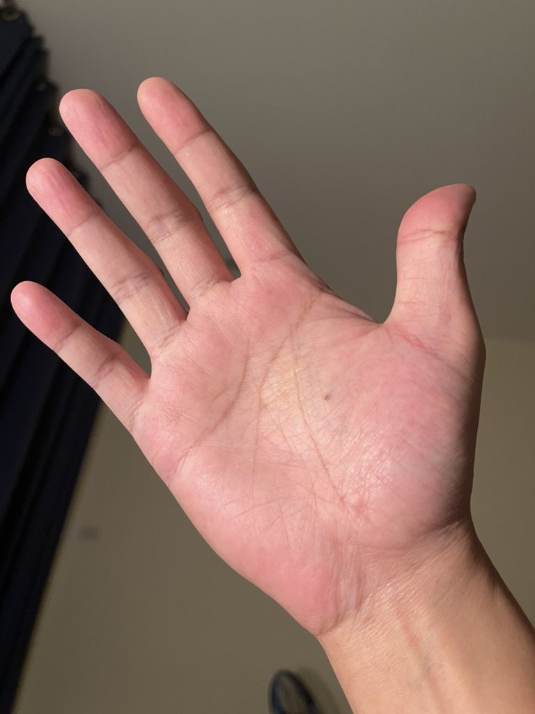 Blurrrrr😵‍💫 tweet media