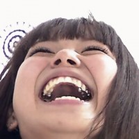 銀歯