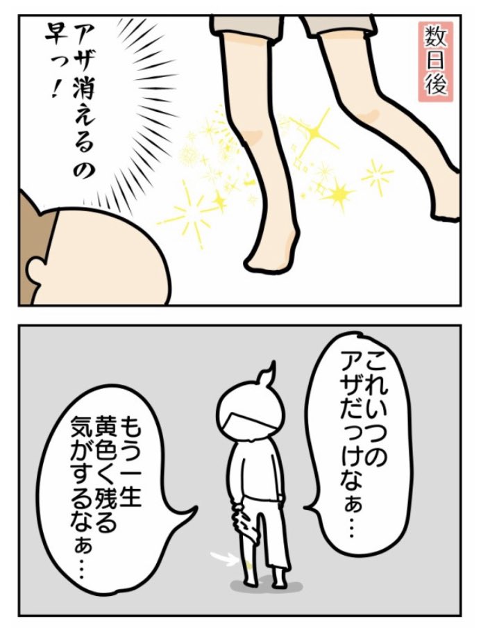 こちとら記憶からは消え去っている謎のアザが一生ものだってのに 