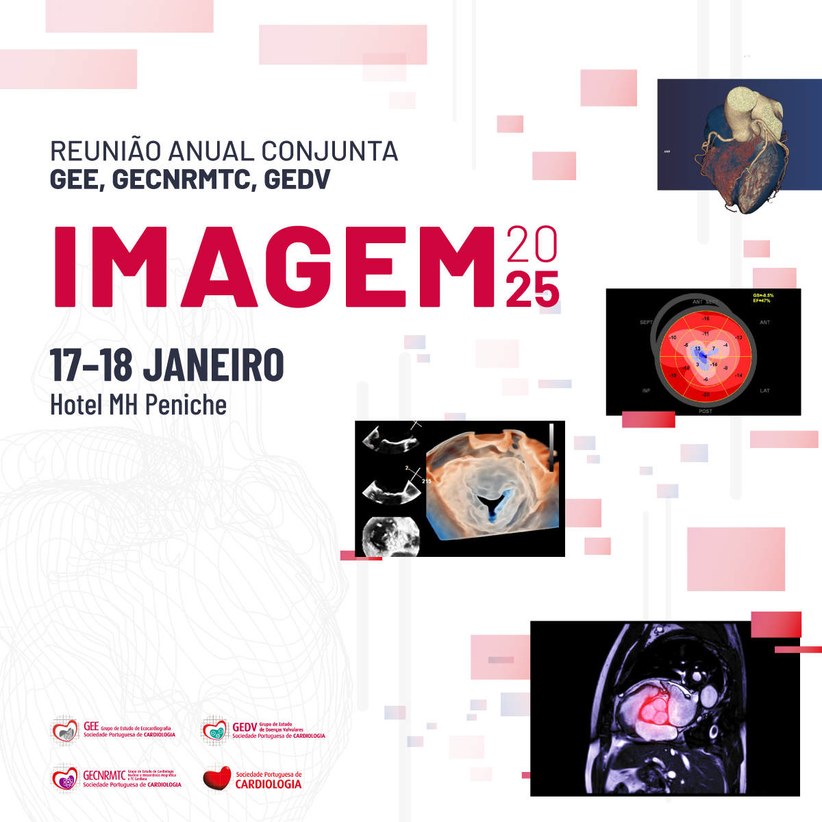 Nos dias 17 e 18 de janeiro, o Hotel MH Peniche vai acolher a Reunião Anual Conjunta dos Grupos de Estudo de Ecocardiografia (GEE), Doenças Valvulares (GEDV) e Cardiologia Nuclear, Ressonância Magnética e TC Cardíaca (GECNRMTC), com um programa dedicado aos avanços em imagem