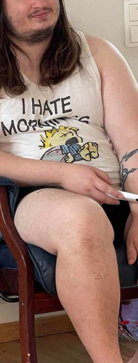 jockeskit's tweet photo. I used to be in good shape, but circumstances can make it hard for people. 19 months ago I was around 140kg now 77kg (130 in the pic 77). The first months were the hardest. I did not get help from medication but Im happy its coming out to help people. Being fat fucking sucks. https://t.co/ZVTVqYZwJx