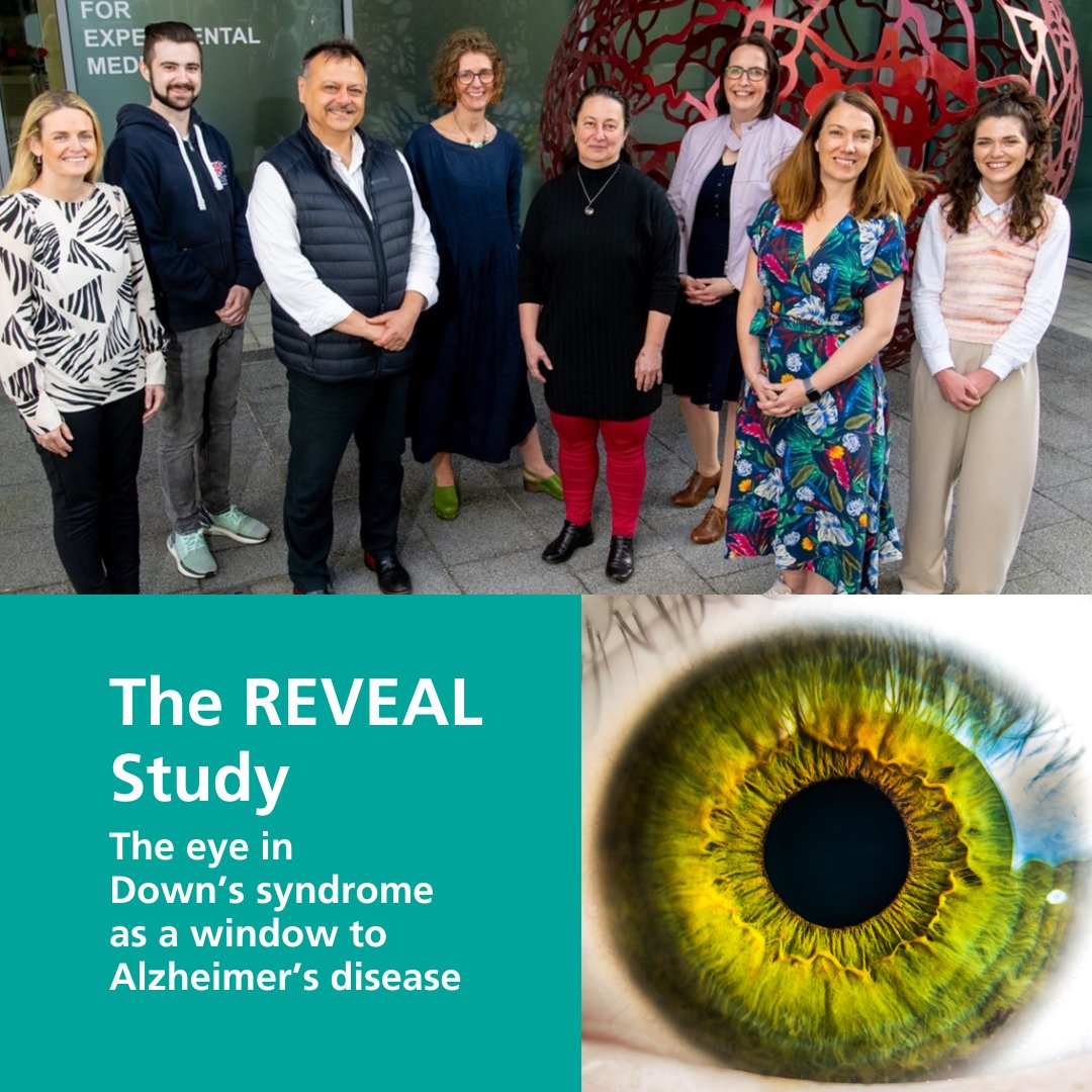 Down's Syndrome Association (@dsainfo) on Twitter photo A team from <a href="/QUBelfast/">Queen's University Belfast 🎓</a> & <a href="/UlsterUni/">Ulster University</a>, the <a href="/REVEAL_Study/">The REVEAL Study</a>, hopes to explore the potential for images of the inside of the eye to provide evidence of the onset of Alzheimer’s Disease before other clinical signs are visible.
Find out more about the study here: loom.ly/rHsooFE A team from <a href="/QUBelfast/">Queen's University Belfast 🎓</a> & <a href="/UlsterUni/">Ulster University</a>, the <a href="/REVEAL_Study/">The REVEAL Study</a>, hopes to explore the potential for images of the inside of the eye to provide evidence of the onset of Alzheimer’s Disease before other clinical signs are visible.
Find out more about the study here: loom.ly/rHsooFE