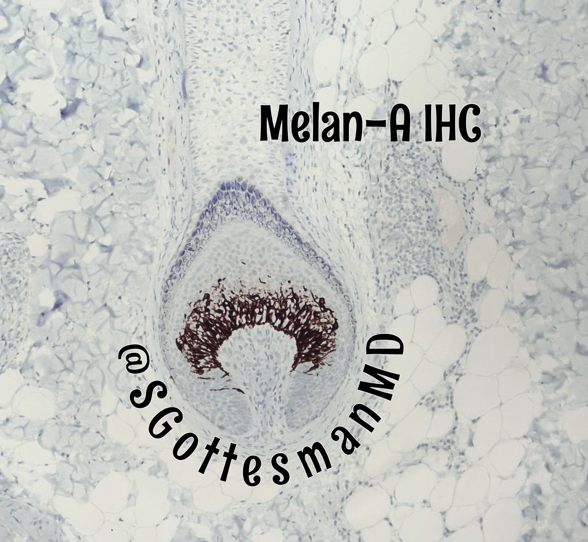 Silvija Gottesman MD tweet media