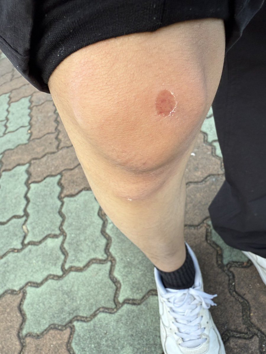sena_REJ's tweet photo. ジェットコースターが人の末路 https://t.co/tKdC59OL4h