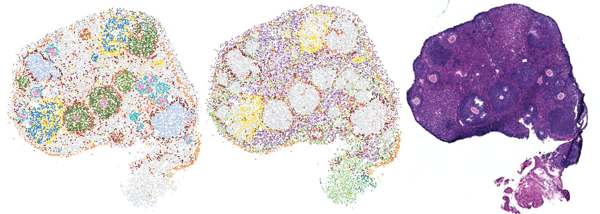 Hattie Chung (@hattaca) on Twitter photo Excited to share our lab's first preprint: we used spatial transcriptomics to dissect how aging disrupts the cycling ovary! 🧵
This was an incredible team effort w/ <a href="/jenngarrison/">Jennifer Garrison</a> <a href="/Tammyinlab/">Tammy Lan</a> <a href="/davidsebfischer/">David Fischer</a> AlisonKochersberger <a href="/RuthRaichur/">Ruth Raichur</a> <a href="/sophiamszady/">Sophia Szady</a> Excited to share our lab's first preprint: we used spatial transcriptomics to dissect how aging disrupts the cycling ovary! 🧵
This was an incredible team effort w/ <a href="/jenngarrison/">Jennifer Garrison</a> <a href="/Tammyinlab/">Tammy Lan</a> <a href="/davidsebfischer/">David Fischer</a> AlisonKochersberger <a href="/RuthRaichur/">Ruth Raichur</a> <a href="/sophiamszady/">Sophia Szady</a>