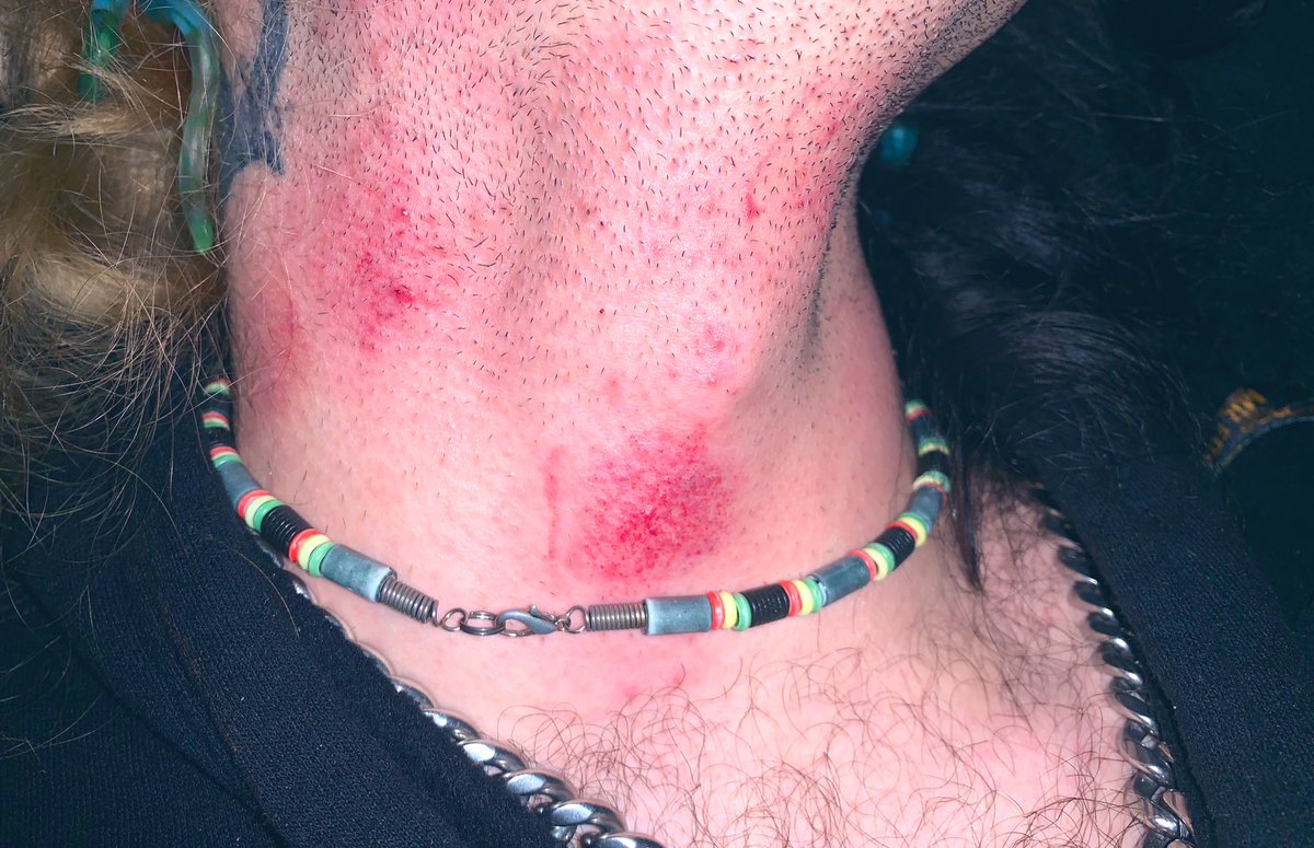 k1llyorslf's tweet photo. I love being marked, especially by sex deprived girls😩 Ughhh like the intensity could just make me go insaneeee!
#NSFW #nsfwtwtًً #emo #alt #hot #bitemarks #hickeys #kinky #bitememore https://t.co/Ro1xTCtBJb