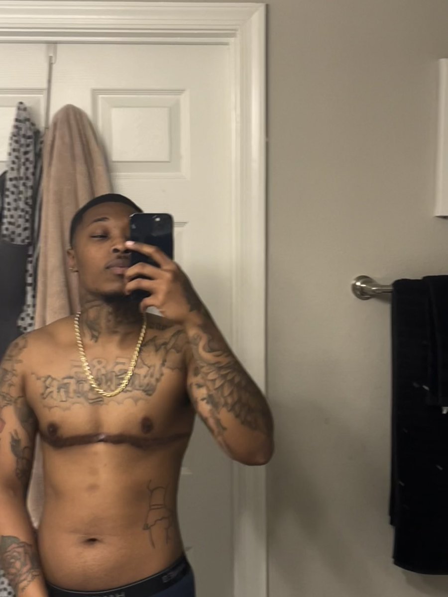 585TRISTAN's tweet photo. Thinking of getting a scar cover tattoo next 🤔 https://t.co/Lc0XVz00q5
