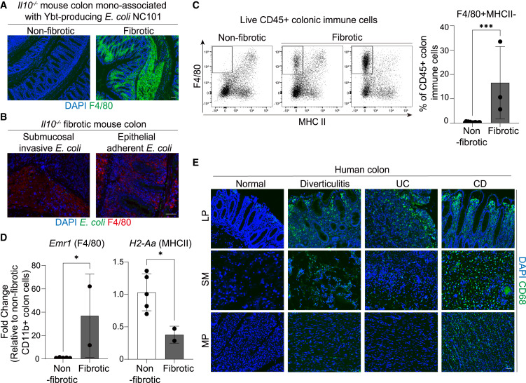 Waggoner Lab (@labwaggoner) on Twitter photo Intestinal E. coli-produced yersiniabactin promotes profibrotic macrophages in Crohn’s disease
cell.com/cell-host-micr…
<a href="/cellhostmicrobe/">Cell Host & Microbe</a> <a href="/ArthurTorchio/">Janelle Arthur</a> Intestinal E. coli-produced yersiniabactin promotes profibrotic macrophages in Crohn’s disease
cell.com/cell-host-micr…
<a href="/cellhostmicrobe/">Cell Host & Microbe</a> <a href="/ArthurTorchio/">Janelle Arthur</a>