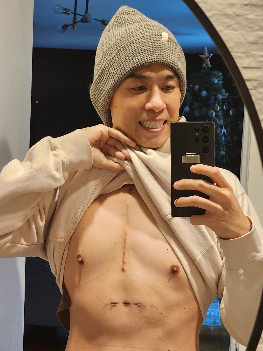 Bills from the hospital are officially starting to come in from my open heart surgery! If anyone wants to contribute to help us financially there is a gofundme that has been set up! Anything helps, even a positive dm from you 😊. Thank you guys! 

gofundme.com/f/fqk7h-suppor…