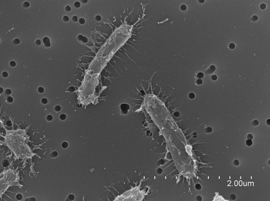 🔴 #ICMNEWS I🔴

🦠Our colleagues from <a href="/EMM_Barcelona/">EMM_Barcelona</a> have discovered >20 new species and genera of biogeochemically significant marine bacteria. They were identified in Blanes Bay, and some are named after great women microbiologists.

🔗 icm.csic.es/en/news/scient…

📷 Xavier Rey