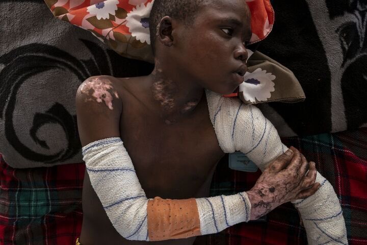 Avaaz (@avaaz) on Twitter photo Sudan is bleeding. Hell is happening before our eyes. Children are starving, women face unspeakable violence, and entire communities are being erased.
<a href="/UN/">United Nations</a> Security Council:
🚨 Break the telecoms blackout.
🚨 Deploy peacekeepers.
🚨 Protect civilians.
The world is watching. Sudan is bleeding. Hell is happening before our eyes. Children are starving, women face unspeakable violence, and entire communities are being erased.
<a href="/UN/">United Nations</a> Security Council:
🚨 Break the telecoms blackout.
🚨 Deploy peacekeepers.
🚨 Protect civilians.
The world is watching.