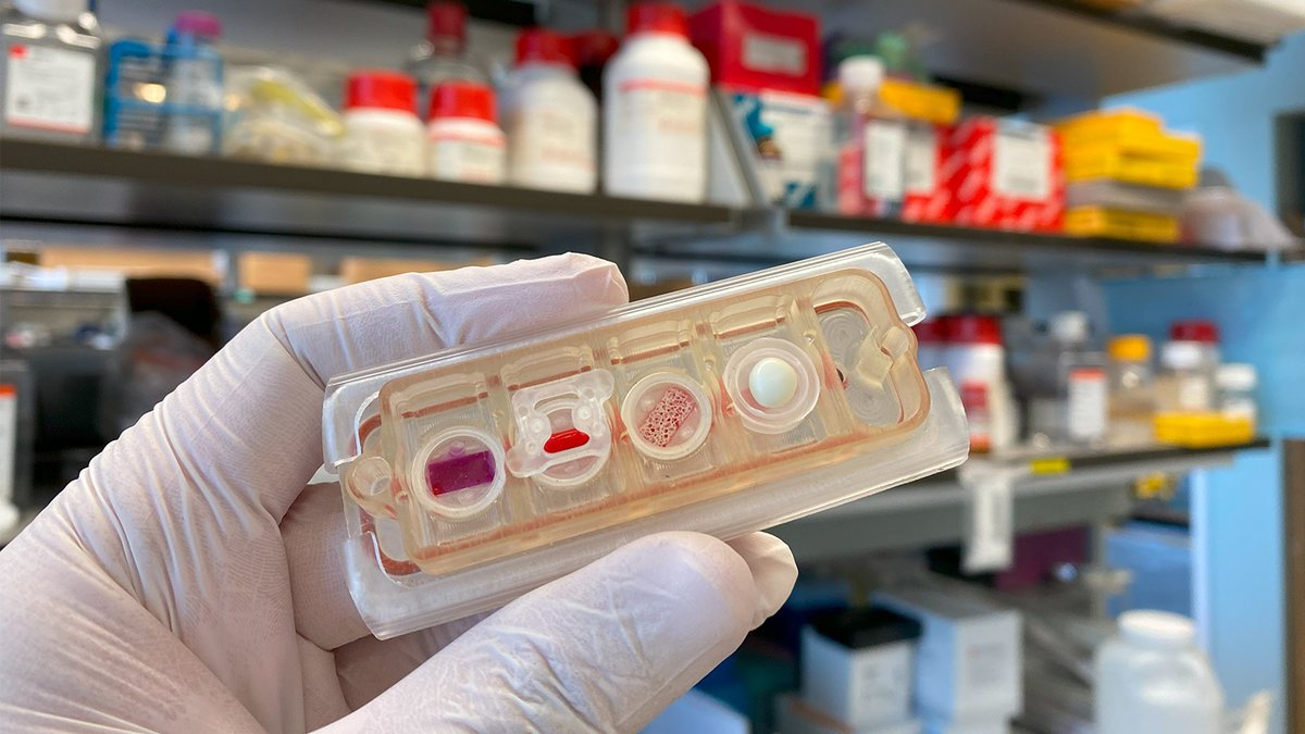 NIBIB (@nibibgov) on Twitter photo As astronauts venture deeper into space, radiation risks soar! To gauge the threat, <a href="/GVNlab/">Gordana Vunjak-Novakovic</a> researchers on Earth are studying the effects of simulated space radiation on human tissue models. Read how their findings could one day protect cosmic explorers: go.nih.gov/GA8G7Za As astronauts venture deeper into space, radiation risks soar! To gauge the threat, <a href="/GVNlab/">Gordana Vunjak-Novakovic</a> researchers on Earth are studying the effects of simulated space radiation on human tissue models. Read how their findings could one day protect cosmic explorers: go.nih.gov/GA8G7Za