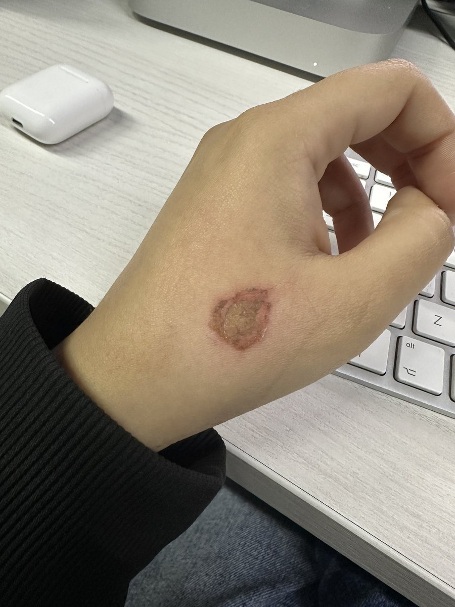 __Closmc's tweet photo. Lo que puede hacer alguien con mucha ansiedad y sin uñas https://t.co/DkXdIhmIi0