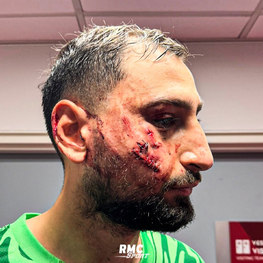 NiyonzimaE3558's tweet photo. Gigio Donnarumma umuzamu wa PSG nyuma yo gukorerwaho ikosa na Singo wa AS Monaco
Abagabo bayabona bayakoreye p umuvandimwe bari bamukuyemo ijisho lmana ikinga akaboko 

#kimasa https://t.co/xU8iBFzklj