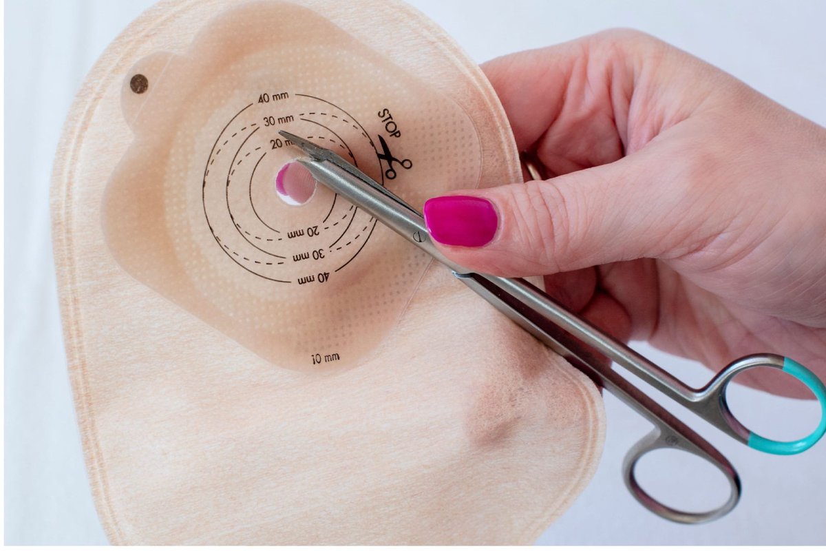 OWConsultancy's tweet image. OpenWater's hydrocolloid formulas 

'When there are delays in delivery, the impact on patients is immeasurable.' 

openwater.uk.com