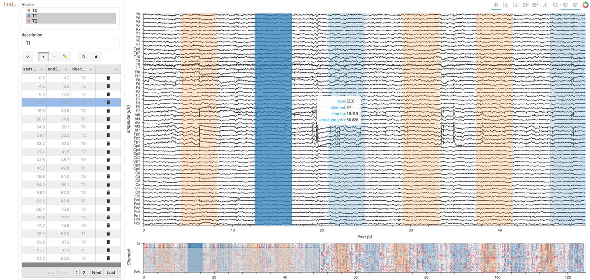 Explore this example showcasing time-aligned visualization of electrophysiological data! 

Dive into our blog post, notebook, and data app to see how we visualize #EMG, #EEG, #LFP, and neural spikes.

👉 examples.holoviz.org/gallery/multic…

 #DataViz <a href="/HoloViz_org/">HoloViz</a> #Electrophysiology