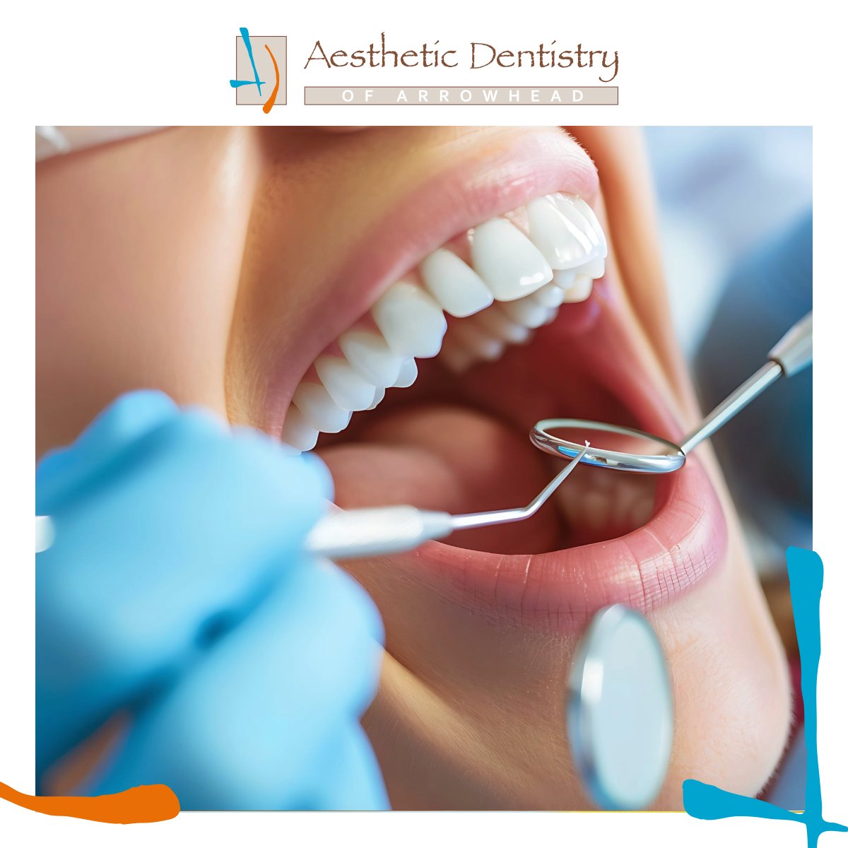 Did you know that composite fillings can last over a decade with the right care? Their longevity depends on various factors, including your dentist's expertise and your daily oral hygiene routine. Ready for a check-up? Contact us today!  📞 623-979-1515