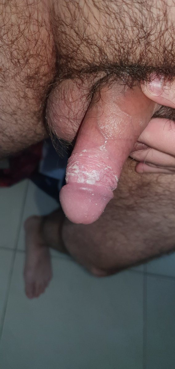 Boykoy1982's tweet photo. Un poco de morbo para cortar la semana 🐷💦🧀😏😈 #smegma #smeg #dirtytoy #manstink #cheesycock #mansmells #ripe #dickcheese #smegmalovers #Pigboy #sebo #queso #cheesedick #mansmells #cockcheese #foreskinsmell #pausujo #dirtycock #cheirao #sebonapica #smegmafetish https://t.co/DVjJkzHnOL