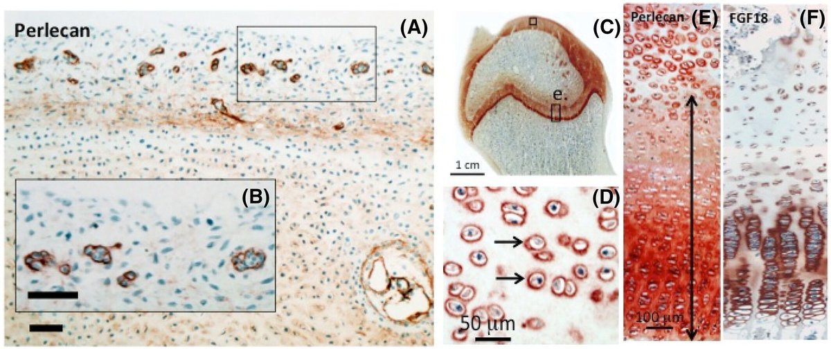 Curious about the roles of perlecan (HSPG2) in the repair of the intervertebral disc? Check out this recent review published in <a href="/JorSpine/">Journal of Orthopaedic Research - Spine®</a>: buff.ly/3ZTcsqv 
#ORSSMC <a href="/Farsh_G/">Farshid Guilak</a> <a href="/Guilak_Lab/">The Guilak Lab</a>