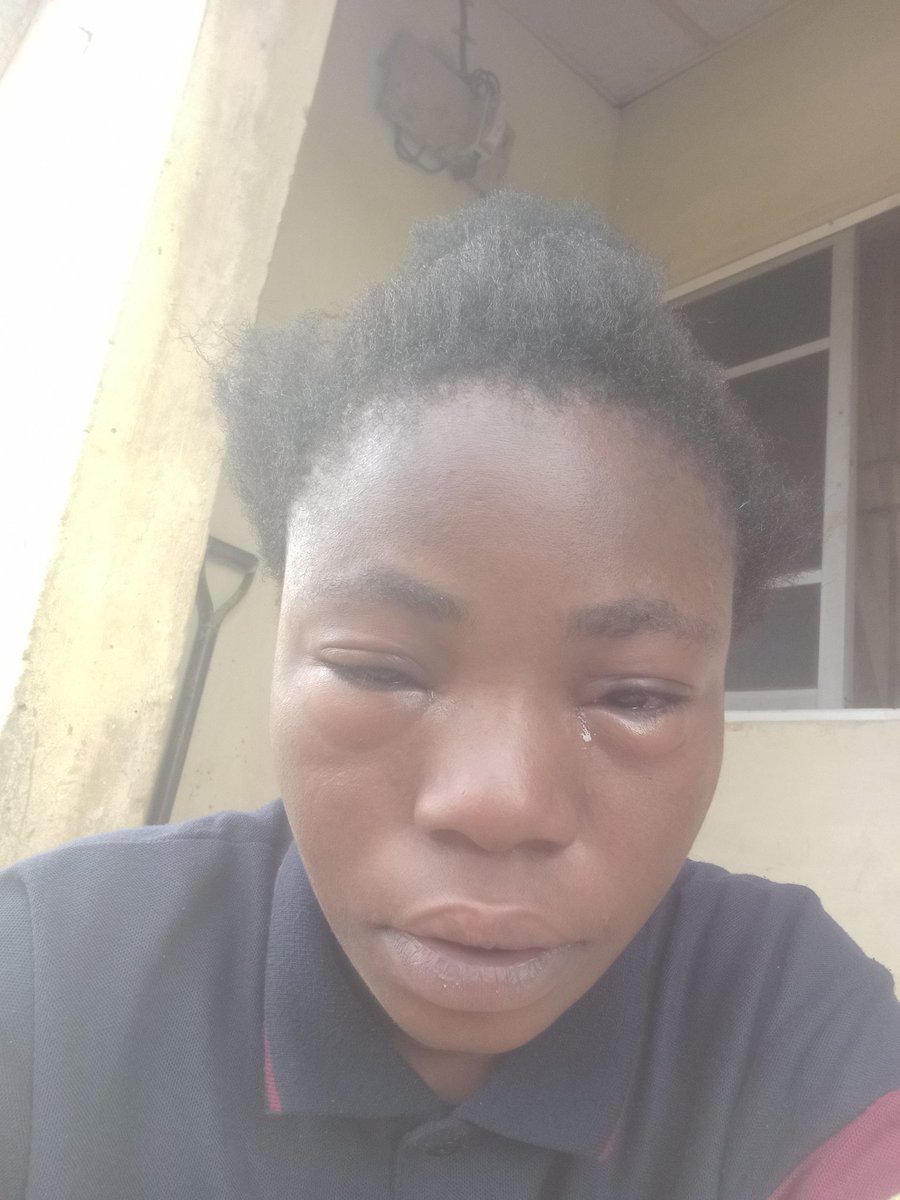 Please help me after the treatment of my eyes no money for feeding nothing is too small 1908030836 access bank
