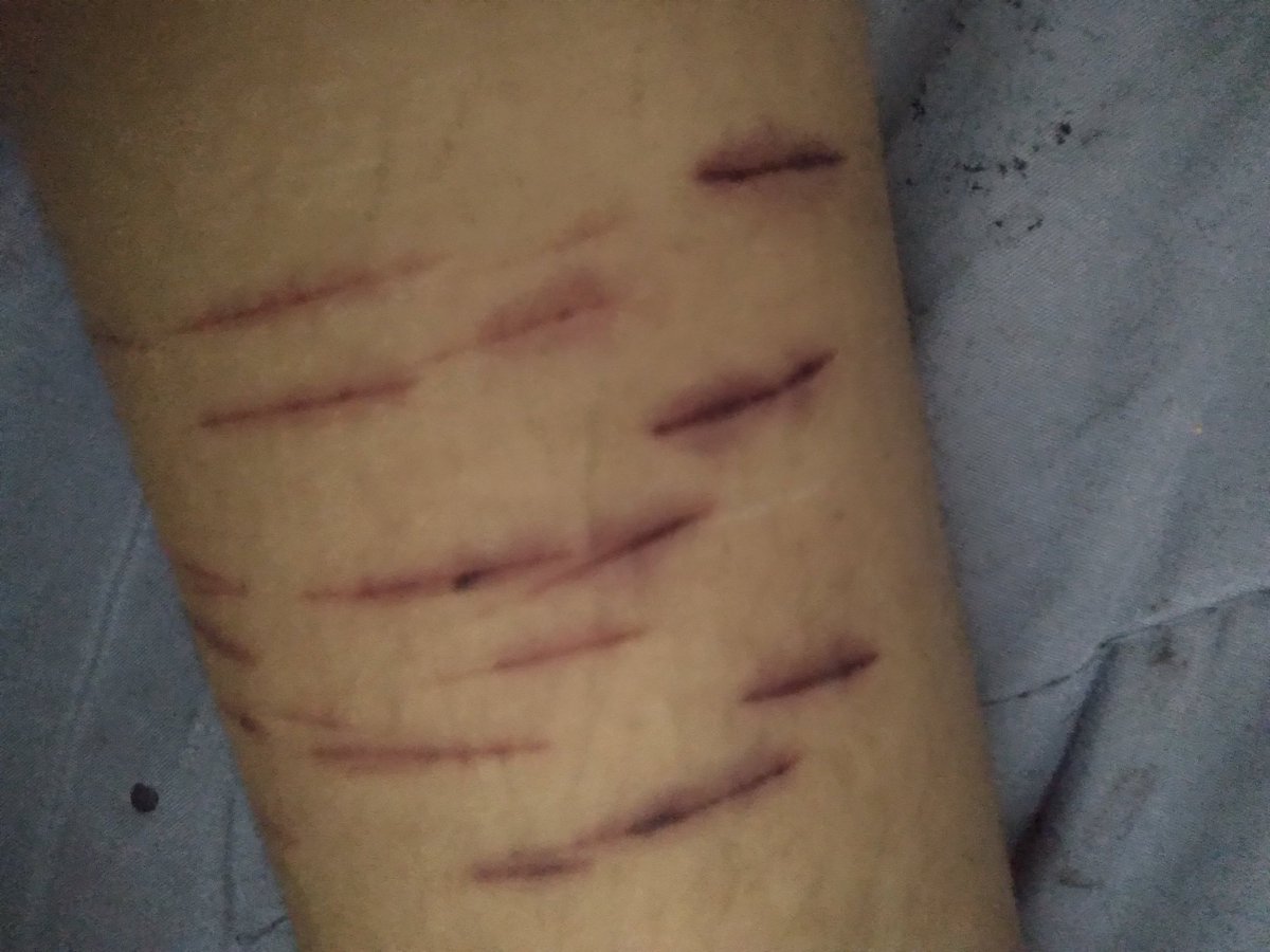 AYUDA XQ SE VE ASI😭 qse me pudre la pataa