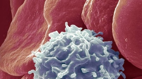 JofCancerPrev's tweet photo. Chronic myeloid leukemia (CML) is a slow-developing cancer of the bone marrow in which immature cells called “blasts” overtake the healthy bone marrow. 
Visit us for more information: https://t.co/pxDxKOvZ23
#chronic #leukemia #myeloid #blood #cells #chromosome #genetic #bone https://t.co/oaF75I0LDg