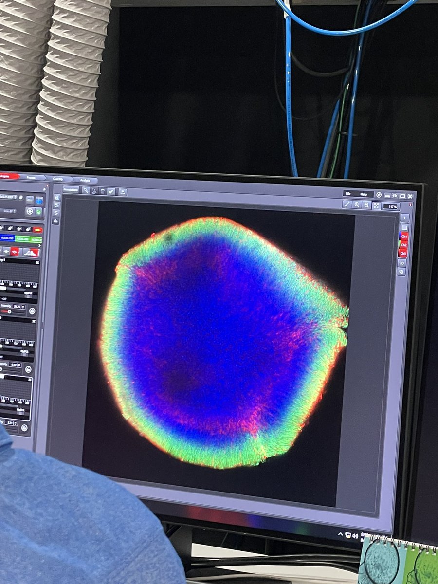 ✅Esta semana nuestra investigadoras <a href="/Lara_C_A/">Lara Cantarero</a> y Natàlia están en el <a href="/SaludISCIII/">Instituto de Salud Carlos III (ISCIII)</a> aprendiendo de primera mano a caracterizar organoides en el “Taller de caracterización molecular, bioquímica y fisiológica de
organoides de cerebro e hígado” organizado por el GdT del @CIBERER 🧫🧬
