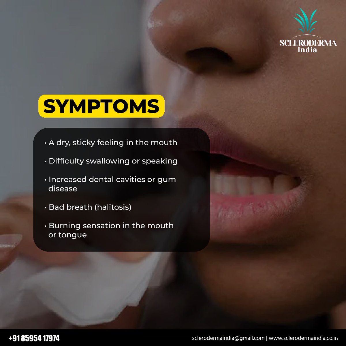 ScleroIndia's tweet image. All you need to know about Dry Mouth (Xerostomia) !
#SclerodermaIndia #Scleroderma #DryMouth #Xerostomia #AutoImmuneDisease #chronicillness