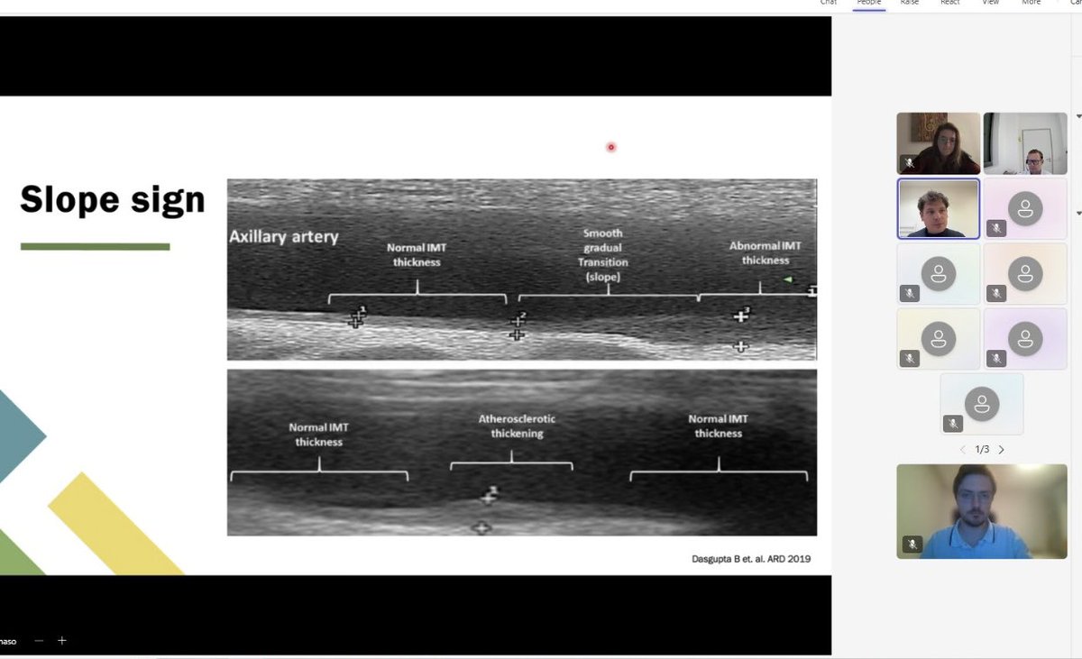 Mire_musi (@mirella_fonti) on Twitter photo Another successful Webinar of our series „To scan is the plan“ 🚨💡
When #rheumatology meets #radiology 👀
Imaging in #vasculitis with our collegues from Bruneck!
<a href="/TBuzzegoli/">Tommaso Buzzegoli</a> <a href="/martinkarner/">Martin Karner</a>
#JÖGR #ÖGR
<a href="/victoriakonzett/">Victoria Konzett</a>
<a href="/philipp_j_bosch/">Philipp Bosch</a> Another successful Webinar of our series „To scan is the plan“ 🚨💡
When #rheumatology meets #radiology 👀
Imaging in #vasculitis with our collegues from Bruneck!
<a href="/TBuzzegoli/">Tommaso Buzzegoli</a> <a href="/martinkarner/">Martin Karner</a>
#JÖGR #ÖGR
<a href="/victoriakonzett/">Victoria Konzett</a>
<a href="/philipp_j_bosch/">Philipp Bosch</a>
