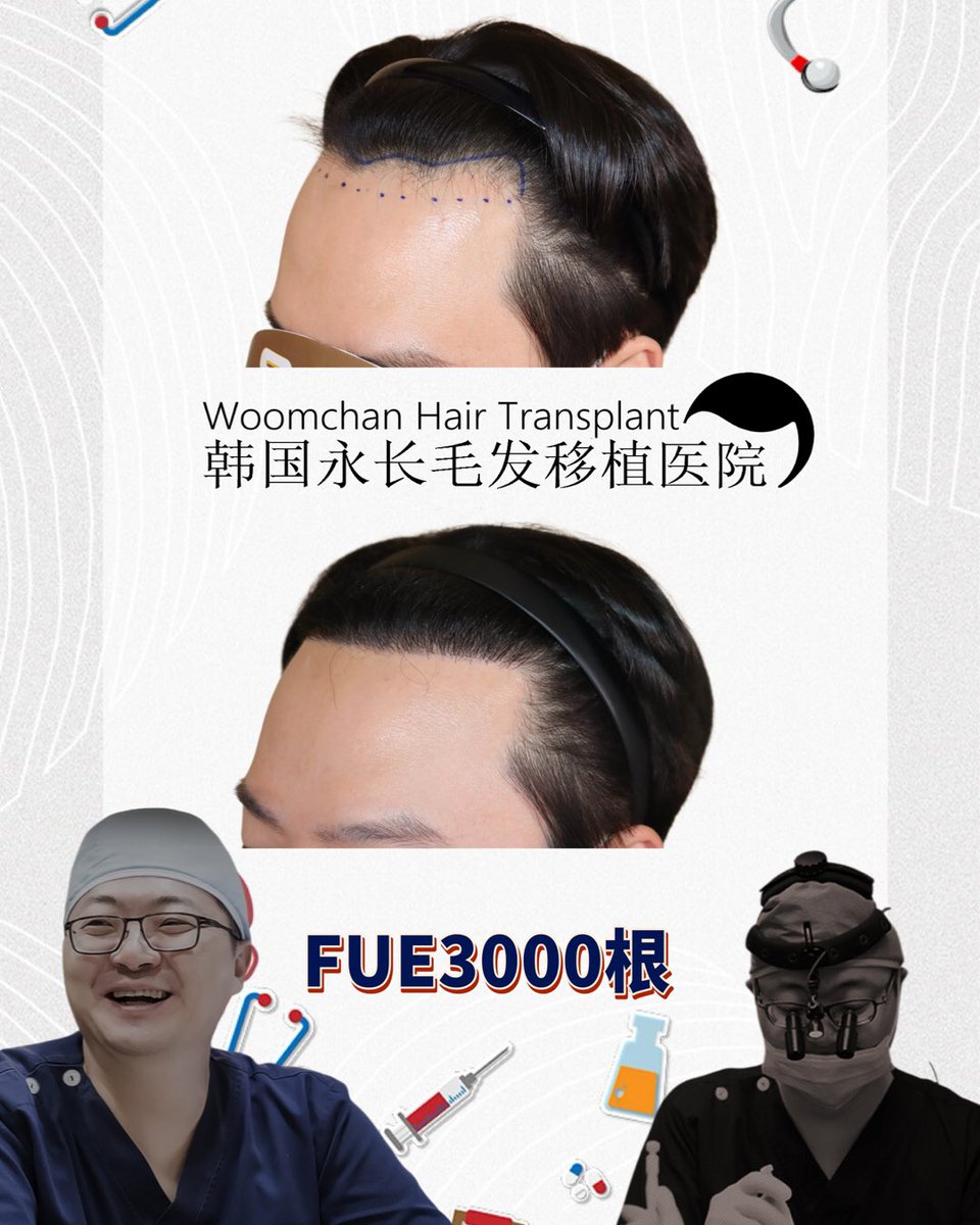 lee910907's tweet photo. FUE3000根加密髮際線
FUE3000 Hairs after 8months
 모발이식3000모 8개월 경과 
微信/  line👉woomchan
whatsapp: +821097895827
https://t.co/IWnWgwD2kc
 #韓國免剃髮植髮 #永長植髮 #woomchan永長植髮 #韩国植发医院 #韩国植髮費用 #hairtransplantsurgery #韓國免剃发植发 #FUE免剃发植 https://t.co/PrQ1uZwZL7