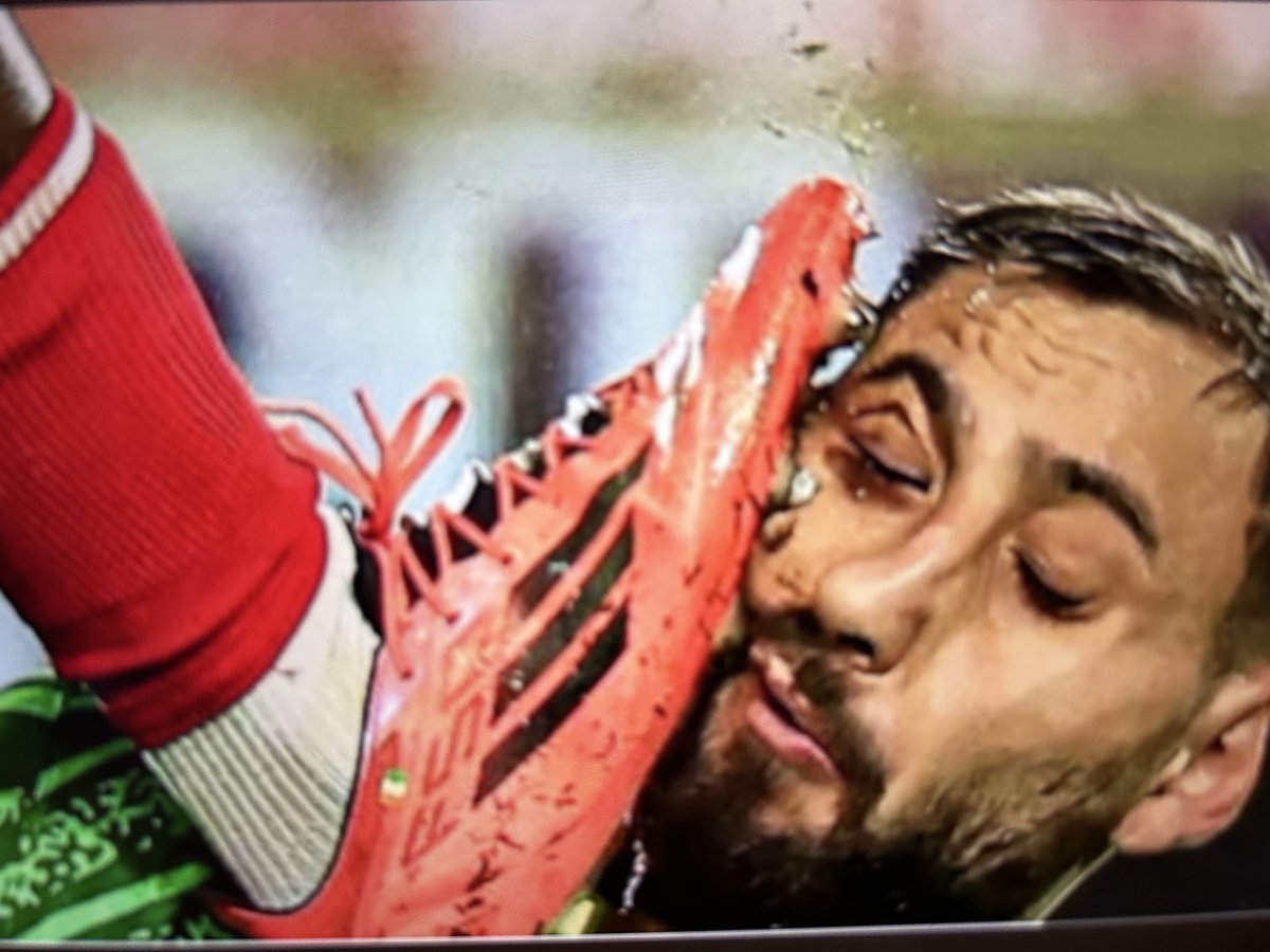 Donc ça c’est permis? 🤬 même l’arbitrage vidéo n’a rien dit… Arrêtez de sortir en croix chers gardiens redevenez les patrons de votre surface de réparation. Comme disait mon père « il vaut mieux faire le boucher plutôt que le veau » 😤