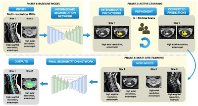 Radiology: Artificial Intelligence (@radiology_ai) on Twitter photo Open source #DeepLearning tool automatically segments the spinal cord and intramedullary lesions on T2-weighted MRI scans doi.org/10.1148/ryai.2… <a href="/ValosekJan/">Jan Valosek</a> <a href="/DrAndrewCSmith/">Andrew C. Smith, PT, DPT, PhD</a> <a href="/DrKenWeber/">Ken Weber, DC, PhD</a> #OpenSource #segmentation #AI Open source #DeepLearning tool automatically segments the spinal cord and intramedullary lesions on T2-weighted MRI scans doi.org/10.1148/ryai.2… <a href="/ValosekJan/">Jan Valosek</a> <a href="/DrAndrewCSmith/">Andrew C. Smith, PT, DPT, PhD</a> <a href="/DrKenWeber/">Ken Weber, DC, PhD</a> #OpenSource #segmentation #AI