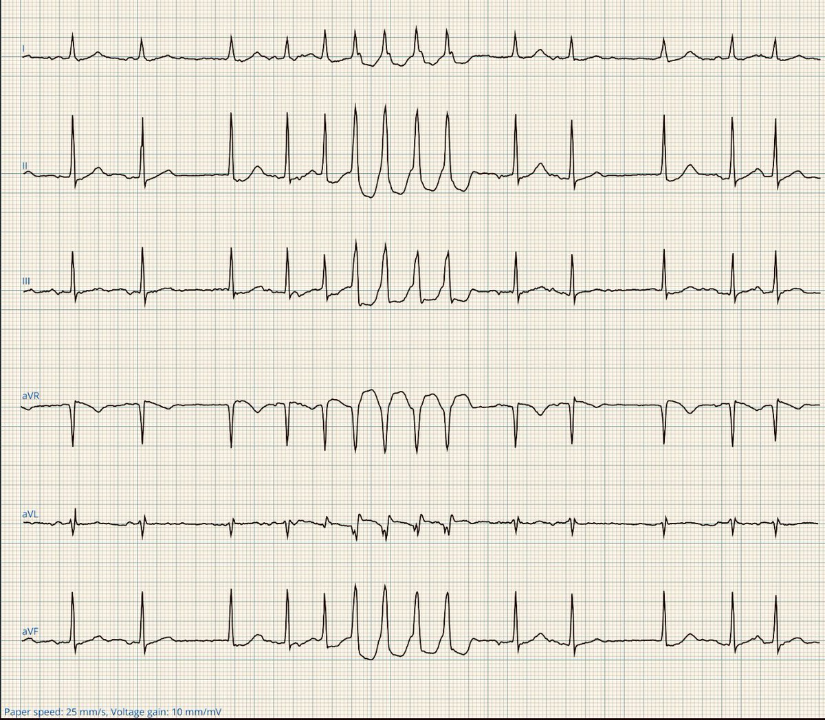 Dr. Andreas Roeschl tweet media