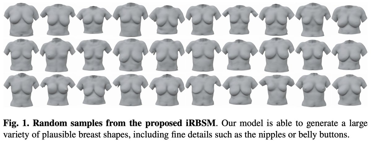 Happy to share our latest 3D generative breast model: the *implicit* RBSM, or iRBSM for short. As opposed to its PCA-based predecessor, the iRBSM leverages implicit neural representations, yielding a highly detailed  and expressive 3D breast model.

Paper: arxiv.org/abs/2412.13244